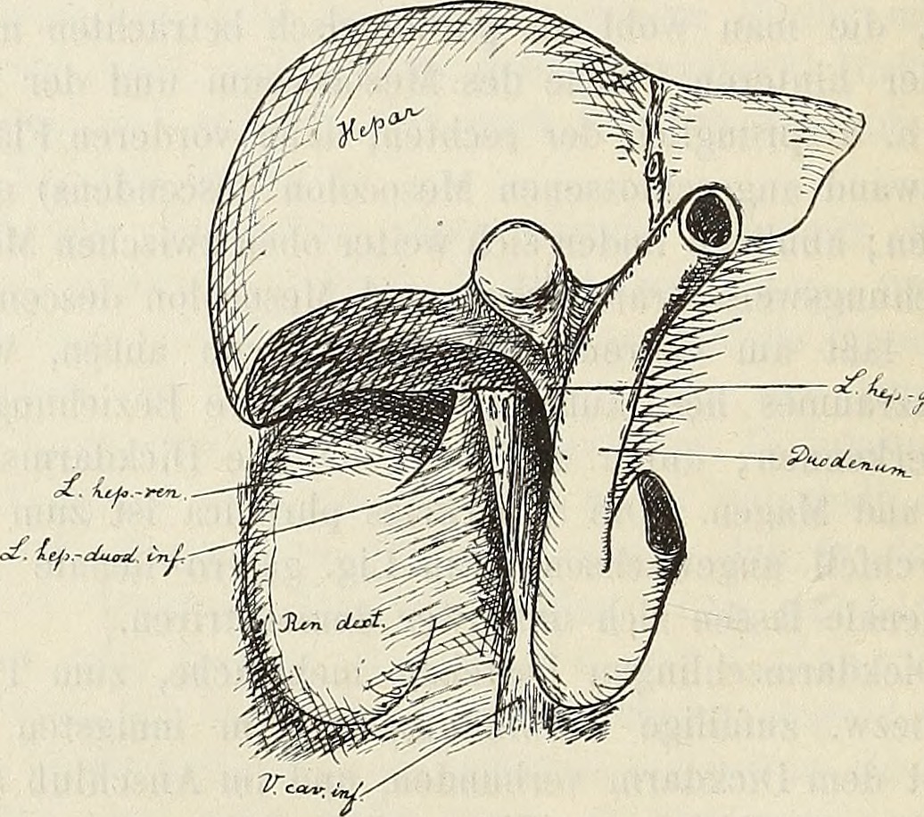 On the four causes of your cholesterol levels being high