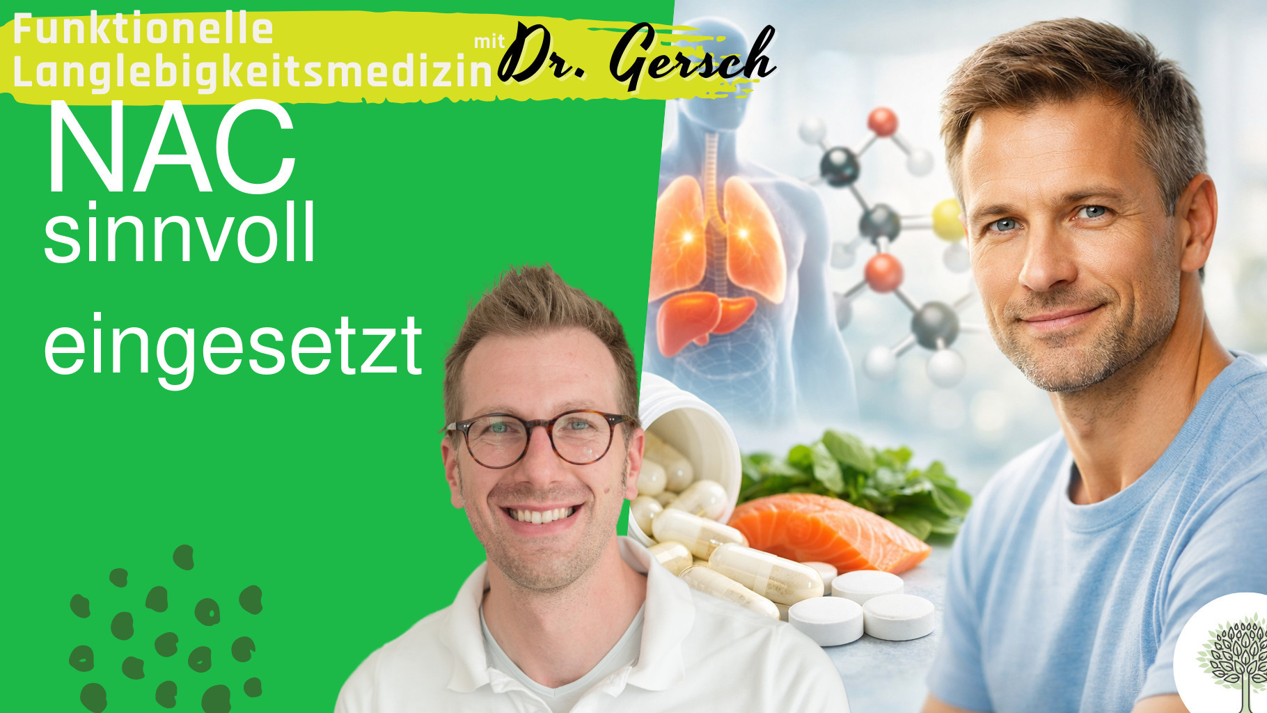 Ist die Supplementierung von N-Acetylcystein sinnvoll?