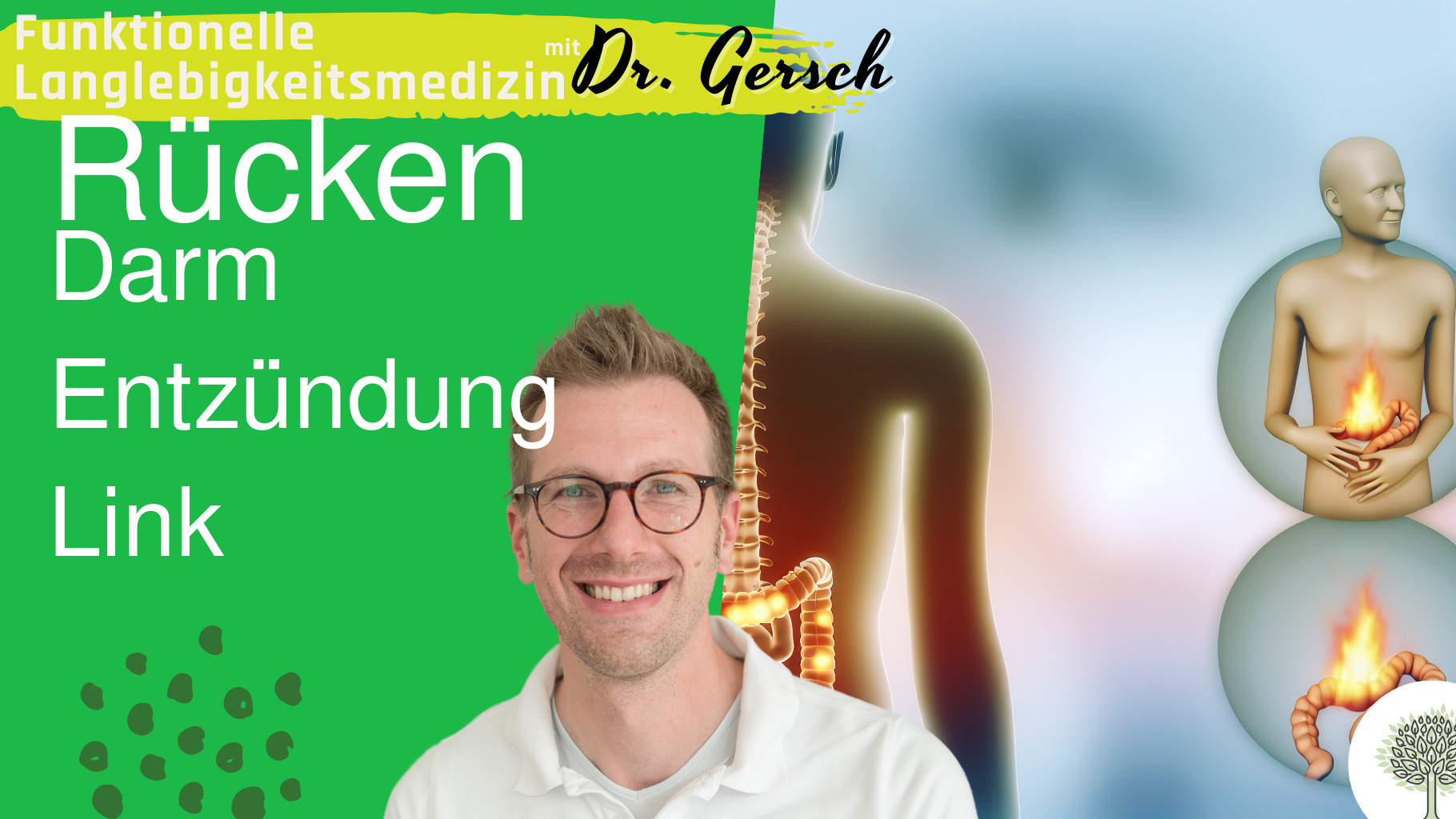 R&uuml;ckenbeschwerden, Darm und Entz&uuml;ndungen