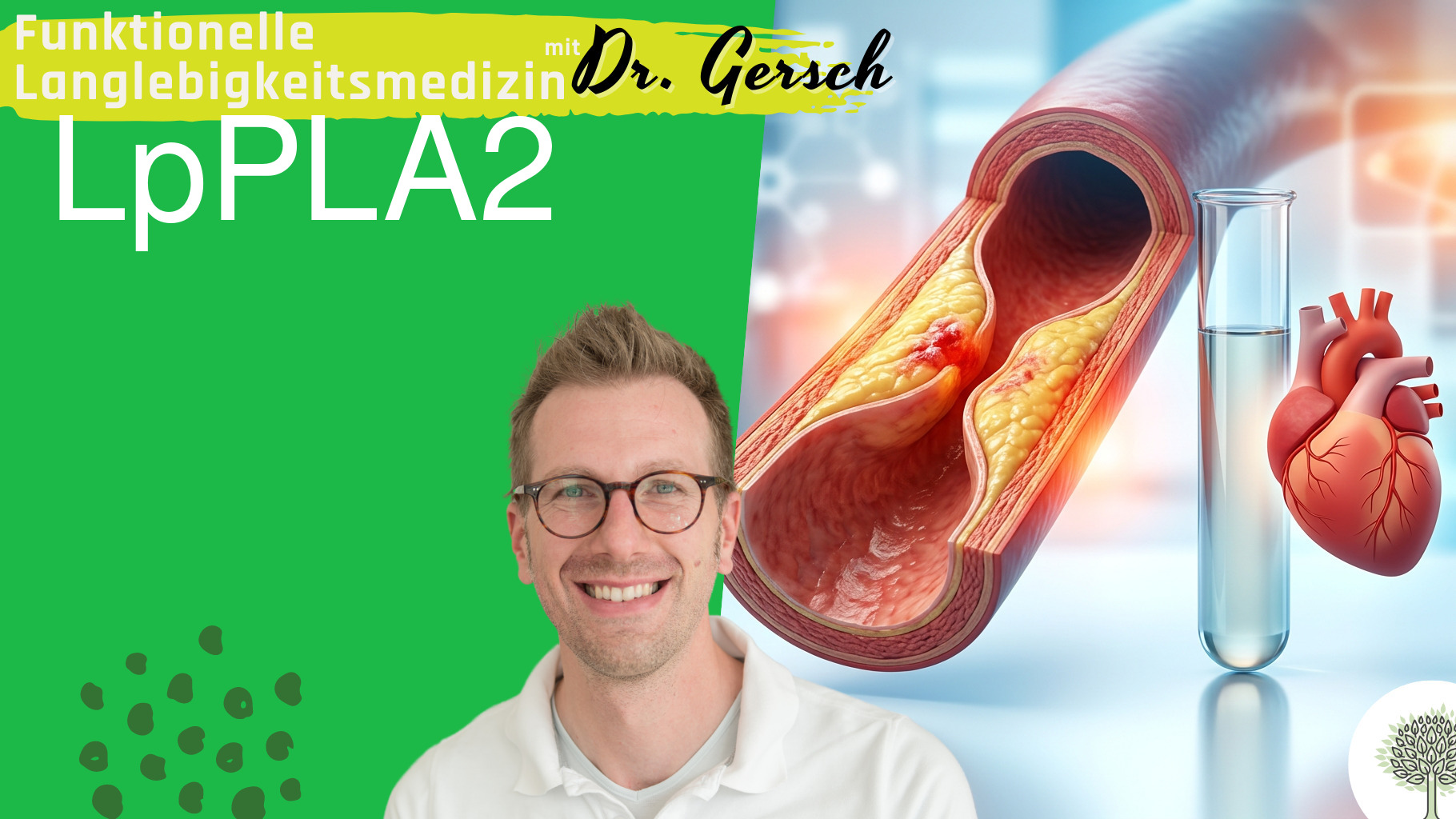Erh&ouml;hte LpPLA2 was tun? Diskussion von Ursachen, nat&uuml;rlicher Entwicklung und Gegenma&szlig;nahmen