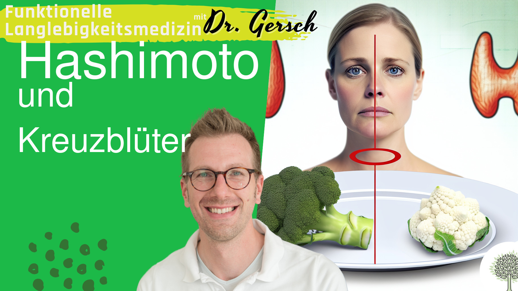 Kreuzbl&uuml;tler bei Hashimoto