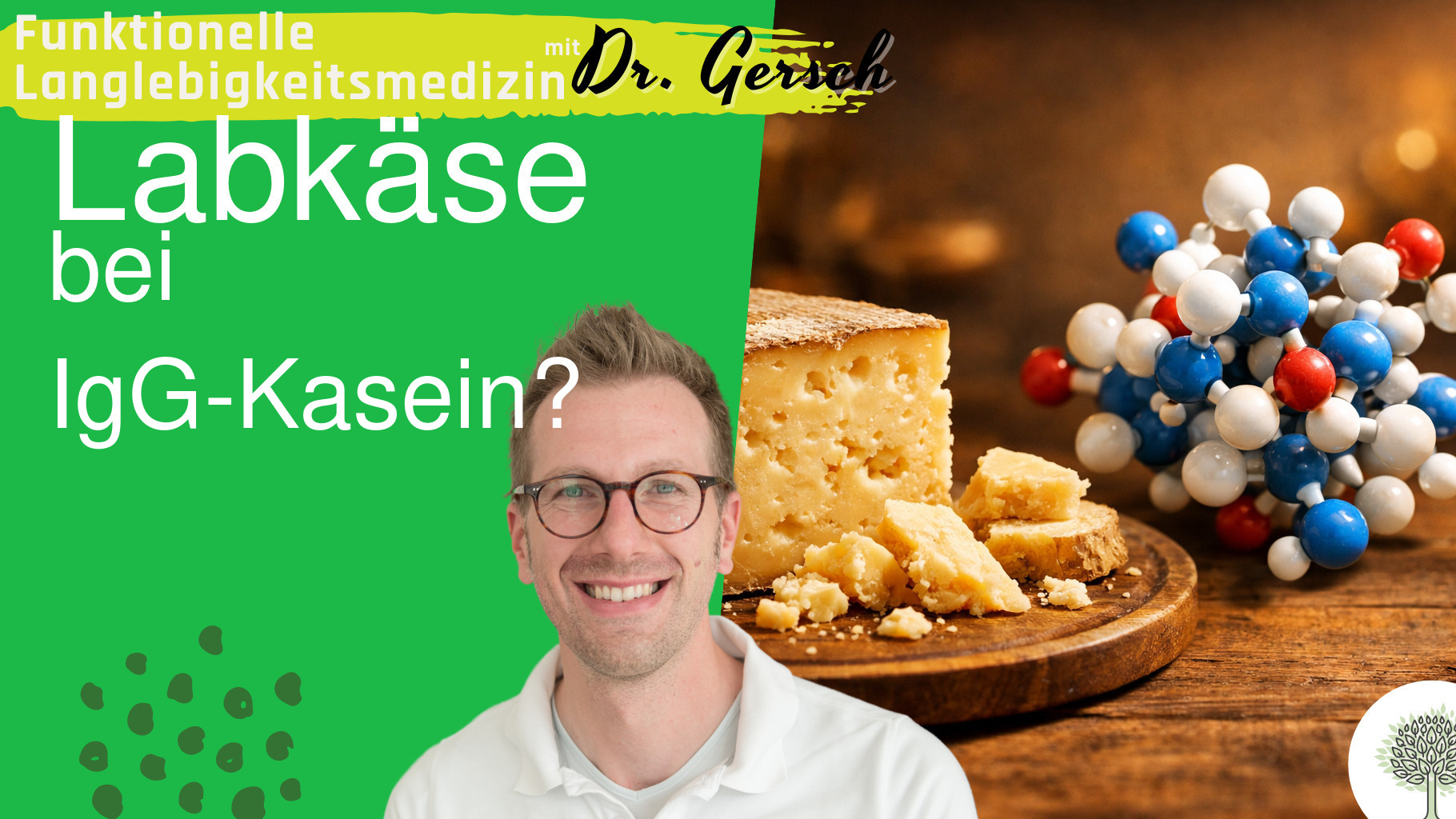 Darf Labk&auml;se auch bei IgG-Antik&ouml;rpern gegen Kasein gegessen werden?