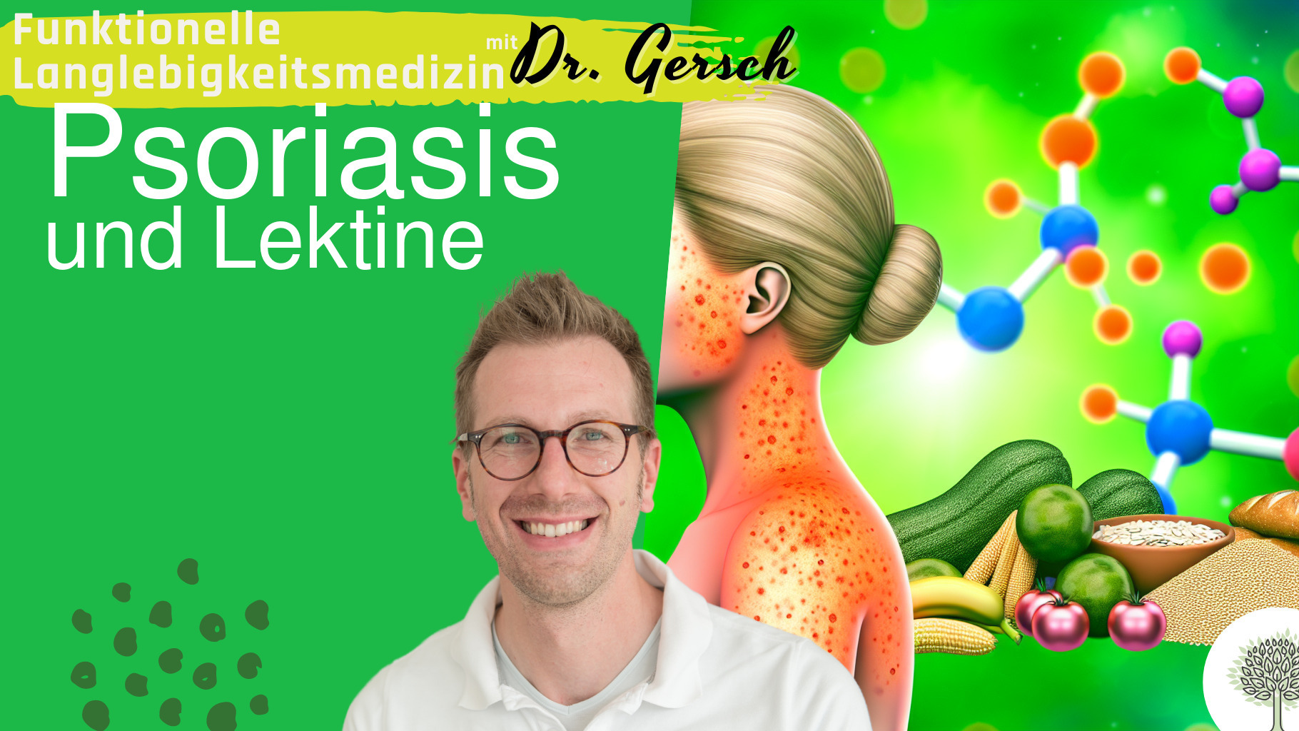 Psoriasis im Kontext lektinfreier Ern&auml;hrung und Hormone